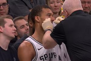 今天强度不小~文班突破被豪泽一掌扇到脸上 有点出血下场处理